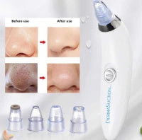 Derma Suction Blackhead Remover Cell Operated*